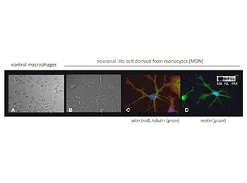 Neuronal-like cells obtained from monocytes
