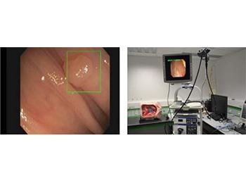 SMART VIDEOCOLONOSCOPY