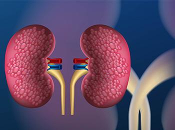Development of new imaging agent as marker of renal function.