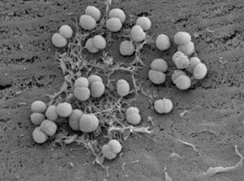 TREATING LIFE-THREATENING PURPURA FULMINANS