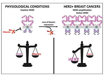 DIAGNOSIS AND/OR PROGNOSIS OF HER2+ CANCERS USING MOESIN AS A BIOMARKER